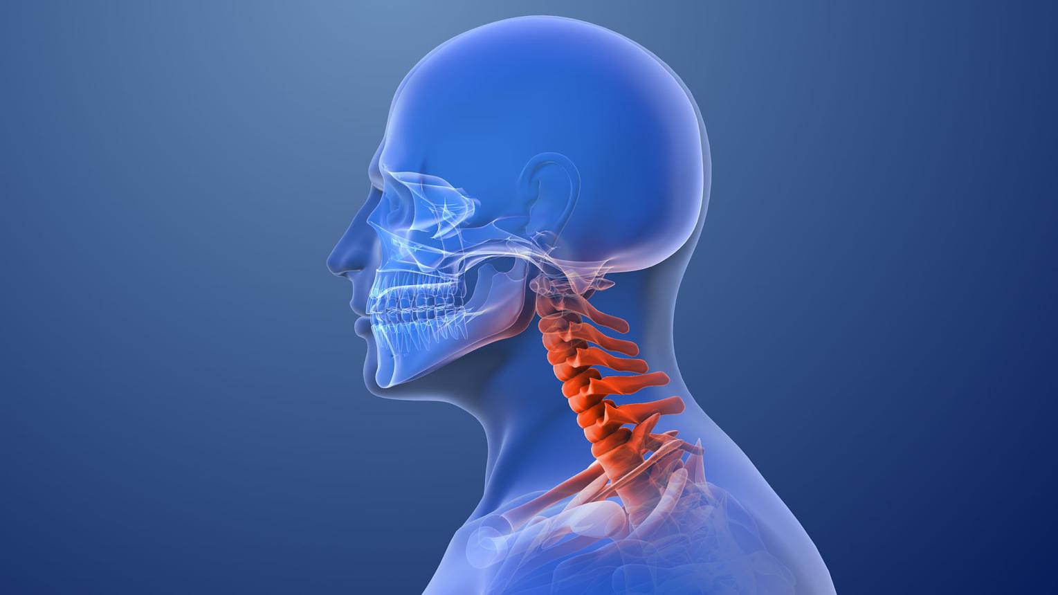 Patient experiencing neck pain from whiplash injury